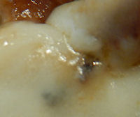 �K�X�g �����n���o�[�O