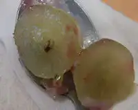 �K�X�g �[���[