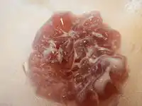 �K�X�g �����[���[