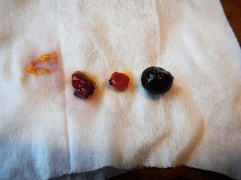 �K�X�g �~�b�N�X�x���[